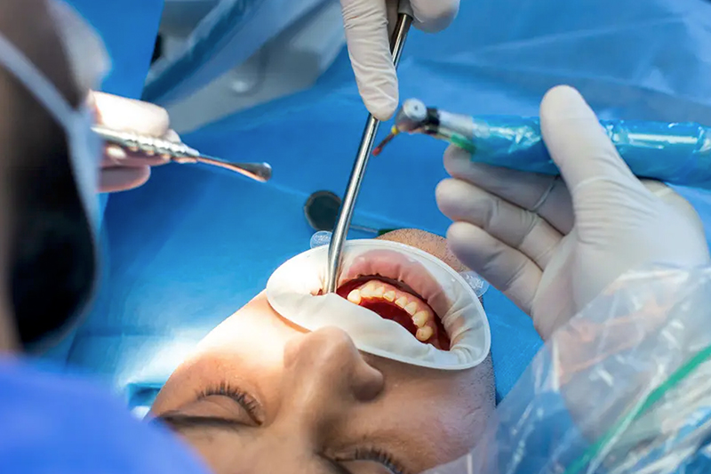¿Qué especialista coloca el implante dental?
