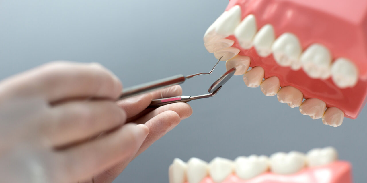 Como cuidar la prótesis dental