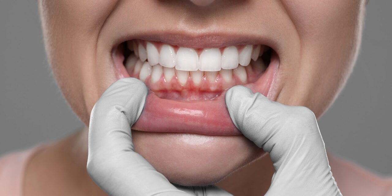 ¿Buscas periodoncista en Boadilla del Monte?