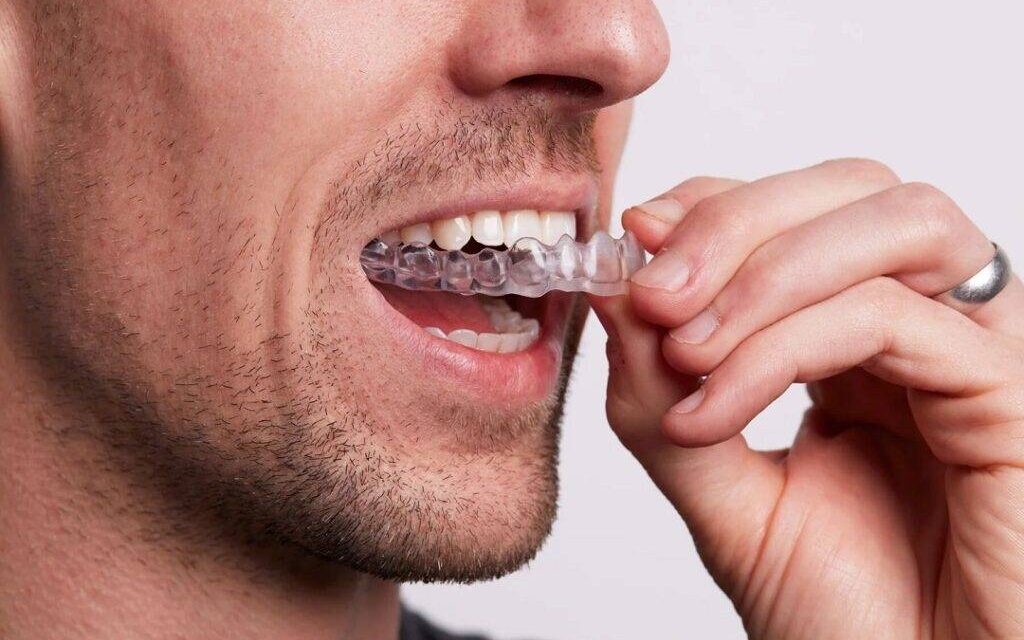 Consejos y recomendaciones para la ortodoncia invisible